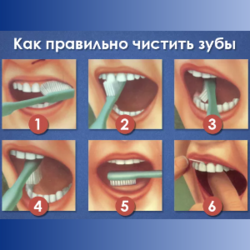 Как правильно чистить зубы?